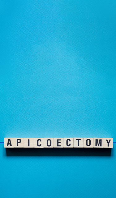 Apicoectomy