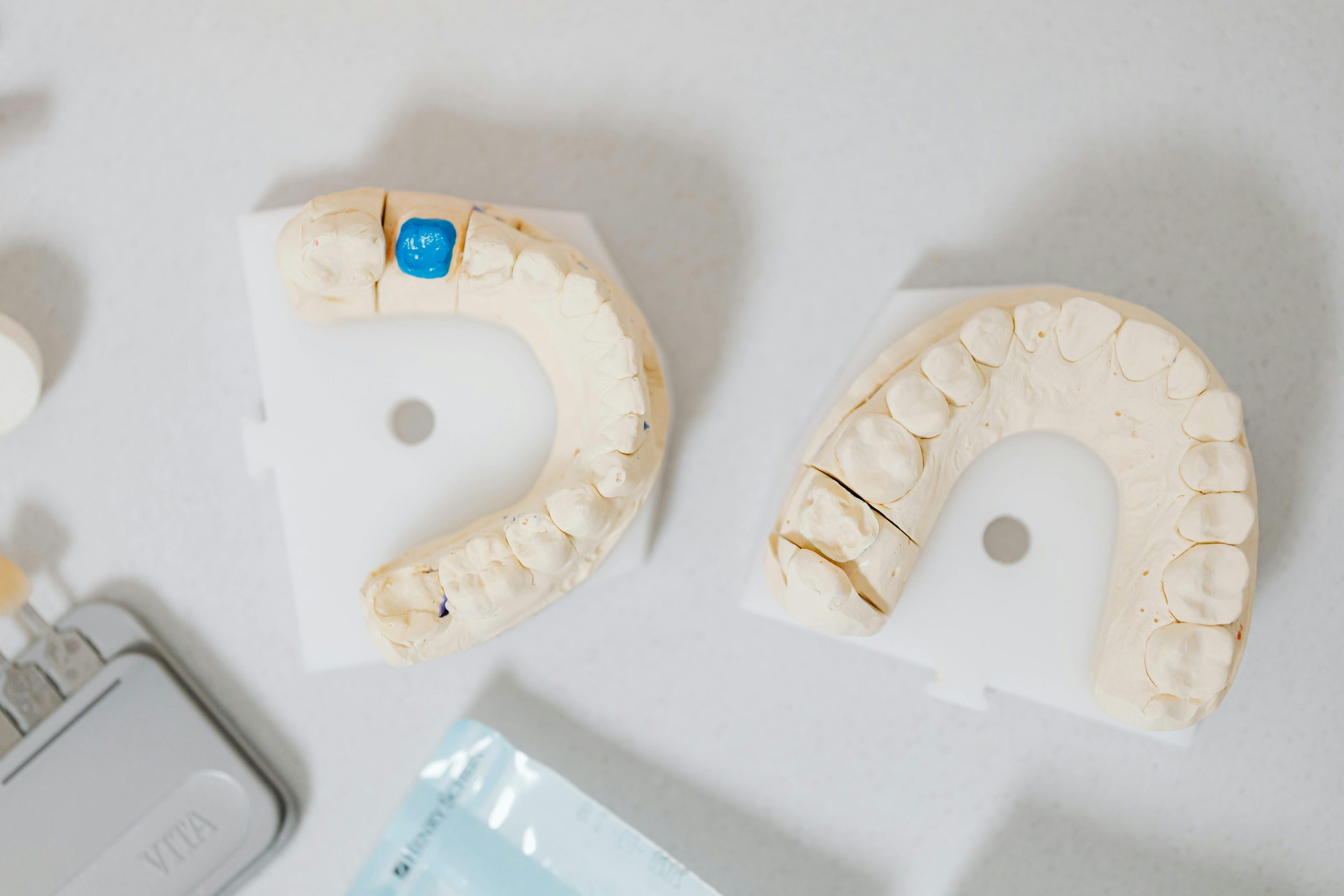 The Benefits of Dental Implants